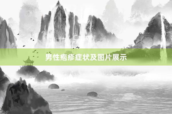 男性疱疹症状及图片展示